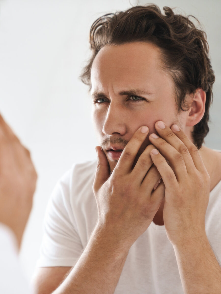 Testosterone Replacement Therapy: Can it Cause Acne Breakouts?